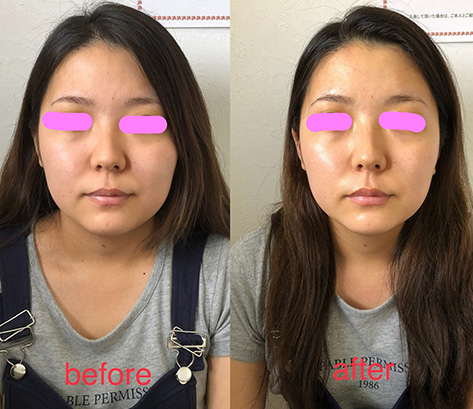 富士市ヨガスタジオ・ヨガパーソナルトレーニングのオリヴィンの施術メニュー、顔均整術